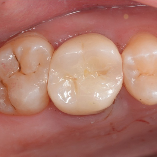 Case.3-6